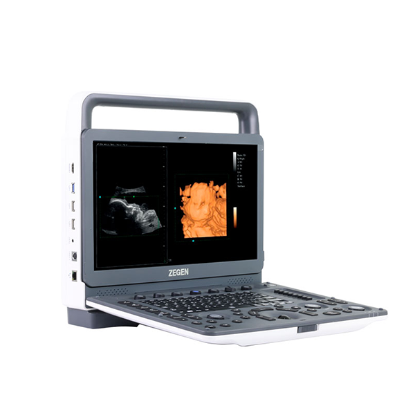 Ultrasonidos portatiles