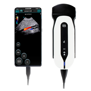 Ultrasonido de Mano SONOEYE-P5